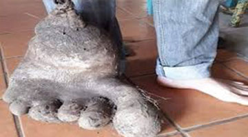 Ngỡ ngàng với củ khoai tây khổng lồ với trọng lượng tới 8kg